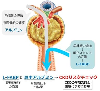 「CKDリスクチェック」検査のメカニズム