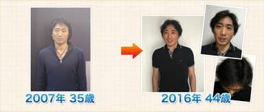 2007年と2016年写真