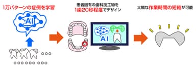 歯科技工AIイメージ図