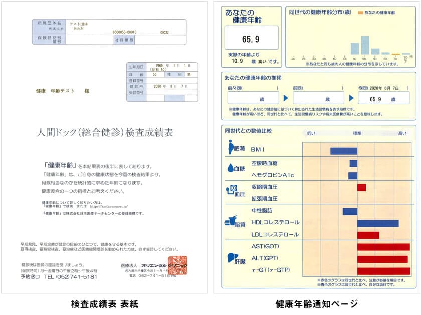 カラダの年齢をあらわす「健康年齢(R)」を
オリエンタルクリニックの人間ドック検査成績表でお知らせ