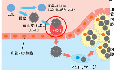 図4　動脈硬化の進行メカニズムとLOX-index(R)