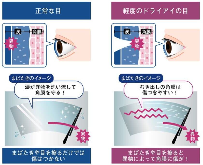 ～目のケアは潤すだけではない。角膜の傷をケアする時代へ。～
目を酷使している人の73％が角膜に傷がついていた！
角膜の傷リスクがわかるチェックリスト＆角膜ケア方法を紹介