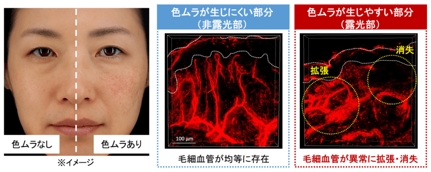 日本メナード化粧品、肌の美しさを低下させる
「色ムラ」が生じるメカニズムを解明！