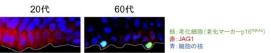 図1 加齢に伴いJAG1の発現が低下する