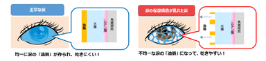 図1　「正常な目」と「油層の不安定化によりドライアイ(目の乾き)になっている目」(イメージ図)