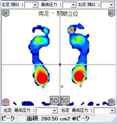 測定画面