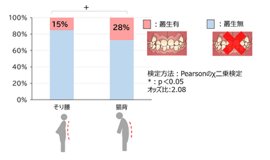 図2　叢生と姿勢の関連性