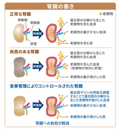 食事管理と腎臓