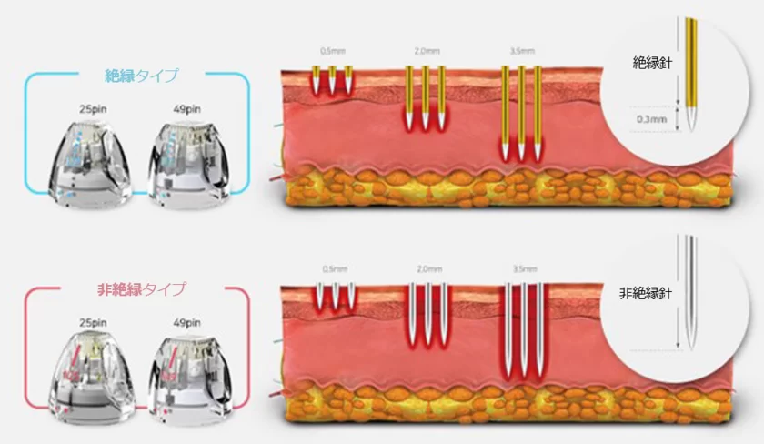 絶縁針と非絶縁針
