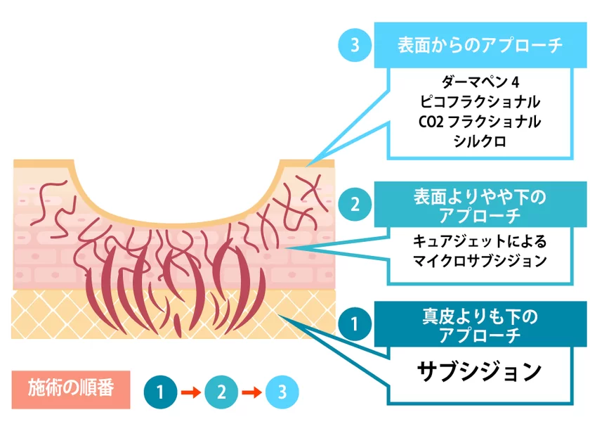 施術の順番